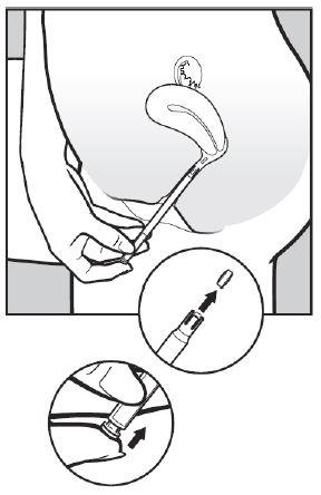 Vagifem Novo Nordisk A/S vaginaltabletter 10 mikrogram