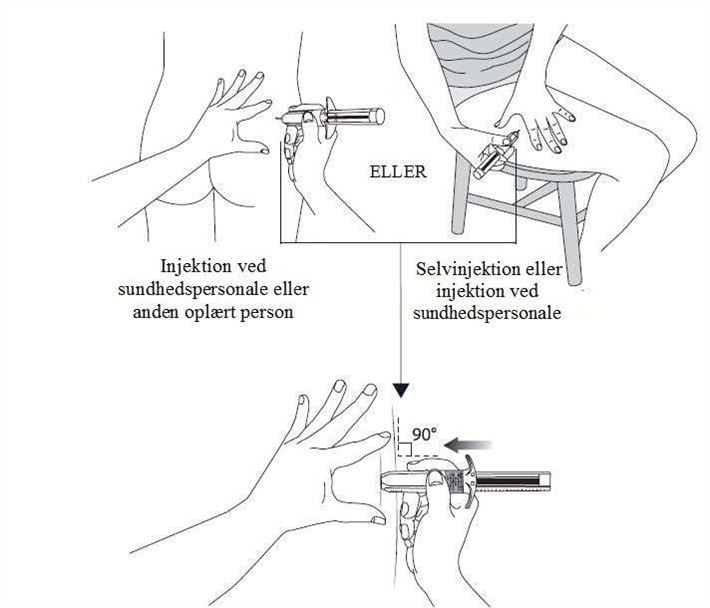 Ipstyl Autogel Institut Produits Synthése (Ipsen) AB injektionsvæske, opløsning i fyldt injektionssprøjte 90 mg