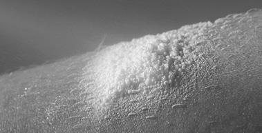 Enstilar Paranova Danmark A/S kutanskum 50 mikrog/g+0,5 mg/g