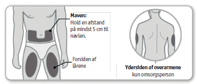 Enbrel® 2care4 ApS injektionsvæske, opløsning i fyldt pen 50 mg 50 mg injektionsvæske, opløsning i fyldt pen