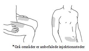 Stelara® Janssen-Cilag International NV, injektionsvæske, opl. i sprøjte 45 mg