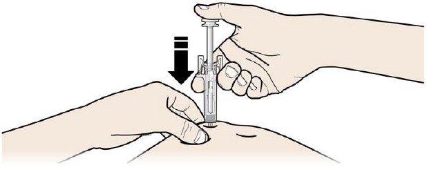 Prolia Abacus Medicine A/S injektionsvæske, opløsning 60 mg/ml