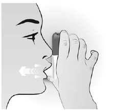 Buventol Easyhaler Orion Corporation inhalationspulver 100 mikrogram/dosis og 200 mikrogram/dosis