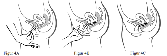 Ornibel vaginalindlæg 120+15 mikrog/24 t Exeltis Healthcare S.L