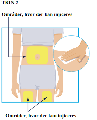 Skyrizi AbbVie Deutschland GmbH &amp; Co. KG injektionsvæske, opløsning i fyldt injektionssprøjte 150 mg
