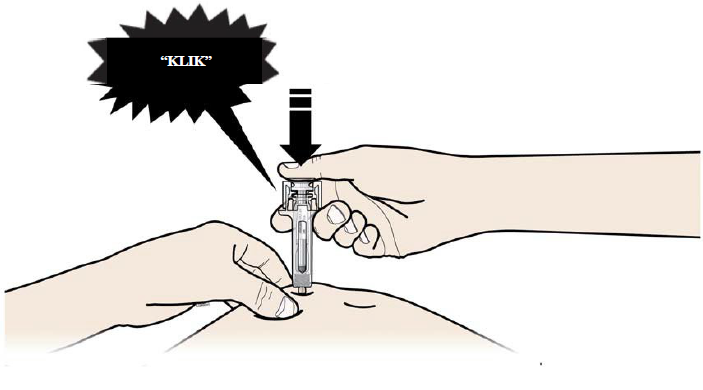 Prolia Abacus Medicine A/S injektionsvæske, opløsning 60 mg/ml