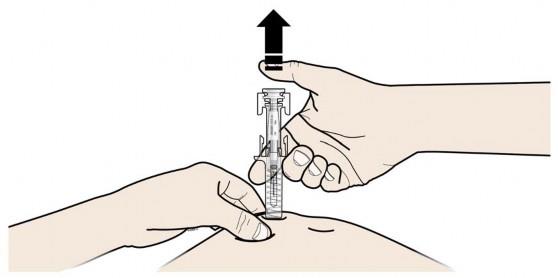 Prolia Amgen Europe BV, injektionsvæske, opl. 60 mg/ml