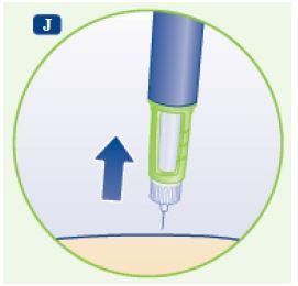 Norditropin Flexpro Flexpro® Novo Nordisk A/S, injektionsvæske, opl. i pen 15 mg/1,5 ml