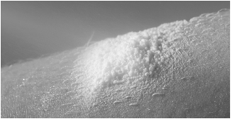 Enstilar 2care4 ApS kutanskum 50 mikrog/g+0,5 mg/g