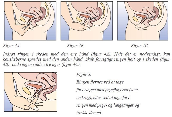 NuvaRing Merck Sharp & Dohme B.V. vaginalindlæg 120+15 mikg/24 timer