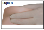 Eligard® pulver og solvens til injektionsvæske, opløsning 45 mg 2care4 ApS