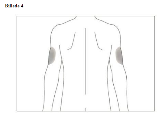 Accofil Accord Healthcare S.L.U. injektions-/infusionsvæske, opløsning, fyldt injektionssprøjte 12 ME/0,2 ml