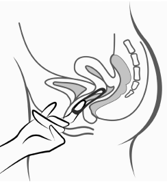 Ornibel vaginalindlæg 120+15 mikrog/24 t Exeltis Healthcare S.L