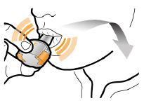 Seebri Breezhaler Novartis Europharm Limited inhalationspulver, hård kapsel 44 mikrogram