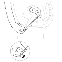 Rewellfem Gedeon Richter Plc. vaginaltabletter 10 mikrogram
