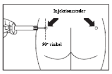 Octreoanne Teva B.V. pulver og solvens til depotinjektionsvæske, suspension 10 mg, 20 mg og 30 mg