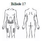 Enbrel Pfizer Ltd pulver og solvens til injektionsvæske, opløsning 25 mg