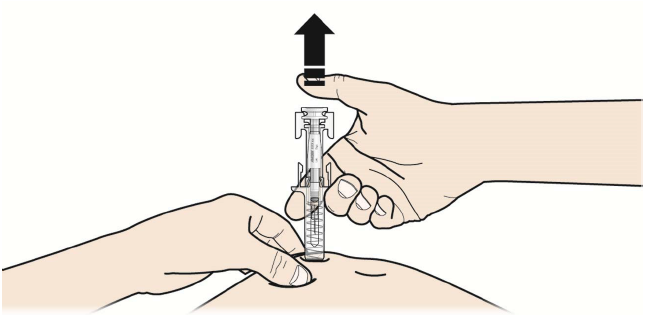 Prolia Orifarm A/S, injektionsvæske, opl. 60 mg/ml