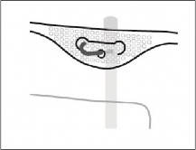 SmofKabiven® Fresenius Kabi AB, infusionsvæske, emulsion