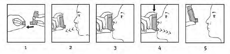 Trimbow Medartuum AB inhalationsspray, opløsning 87 + 5 + 9 mikrogram