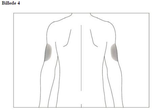 Accofil Accord Healthcare S.L.U. injektions-/infusionsvæske, opløsning, fyldt injektionssprøjte 70 ME/0,73 ml