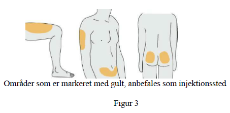 Uzpruvo injektionsvæske, opløsning i fyldt injektionssprøjte 45 mg STADA Arzneimittel AG