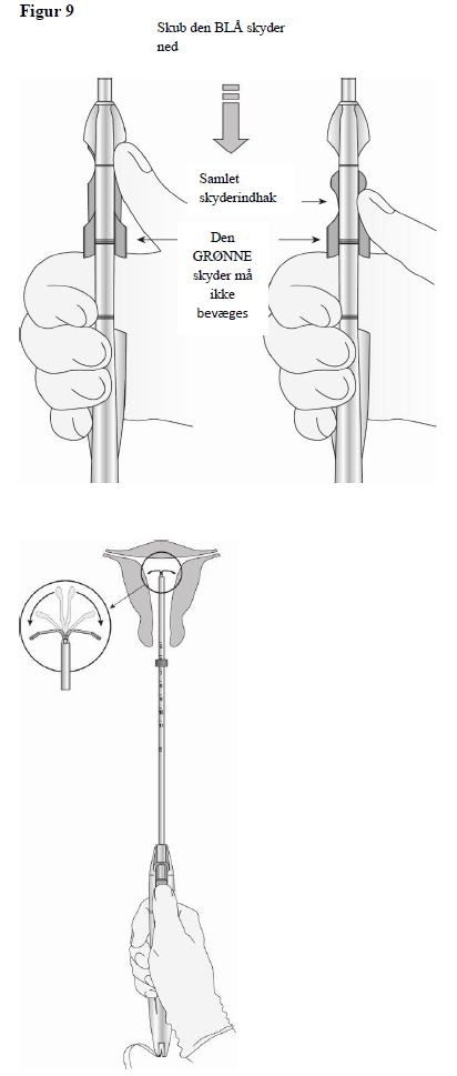 Levosert One Gedeon Richter Plc. intrauterint indlæg 20 mikrogram/24 timer