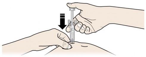 Prolia Amgen Europe BV, injektionsvæske, opl. 60 mg/ml