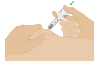 Imraldi injektionsvæske, opløsning i fyldt injektionssprøjte 40 mg/0,4 ml Samsung Bioepis NL B.V.