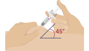 Imraldi injektionsvæske, opløsning i fyldt injektionssprøjte 40 mg/0,4 ml Samsung Bioepis NL B.V.