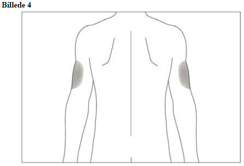 Accofil Accord Healthcare S.L.U. injektions-/infusionsvæske, opløsning, fyldt injektionssprøjte 48 ME/0,5ml