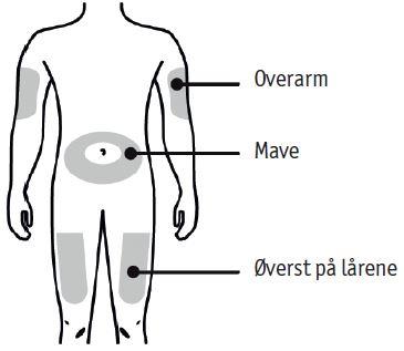 Prolia 2care4 ApS injektionsvæske, opløsning 60 mg/ml