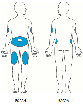 Trulicity Orifarm A/S injektionsvæske, opløsning i fyldt pen 1,5 mg