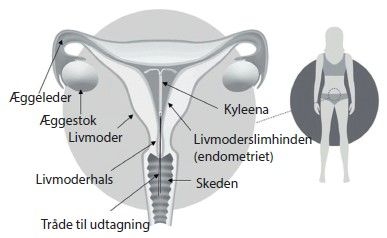 Kyleena intrauterint indlæg 19,5 mg 2care4 ApS