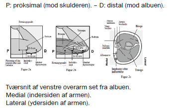 Nexplanon Paranova Danmark A/S implantat 68 mg