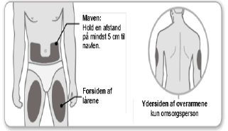 Enbrel Paranova Danmark A/S injektionsvæske, opløsning i fyldt pen 50 mg 50 mg injektionsvæske, opløsning i fyldt pen