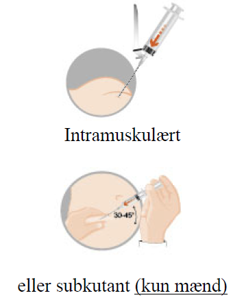 Pamorelin Institut Produits Synthése (Ipsen) AB depotinjektionsvæske, pulver og solvens til suspension 3,75 mg