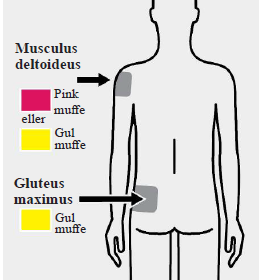 Trevicta Medartuum AB depotinjektionsvæske, suspension 525 mg