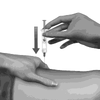 Avonex Biogen Idec Limited injektionsvæske, opløsning 30 mikrogram/0,5 ml