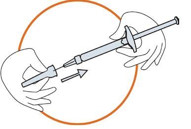 Icatibant Accord Accord Healthcare S.L.U. injektionsvæske, opløsning i fyldt injektionssprøjte 30 mg
