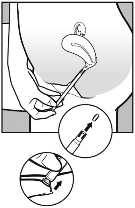 Vagifem 10 mikrogram vaginaltabletter