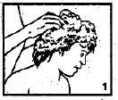 Nix ACO Hud Nordic AB shampoo 1%