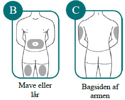 Bimzelx UCB Pharma S.A. injektionsvæske, opl. i pen 160 mg