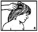 Nix ACO Hud Nordic AB shampoo 1%