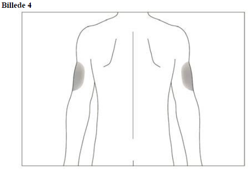 Accofil Accord Healthcare S.L.U. injektions-/infusionsvæske, opløsning, fyldt injektionssprøjte 30 ME/0,5ml