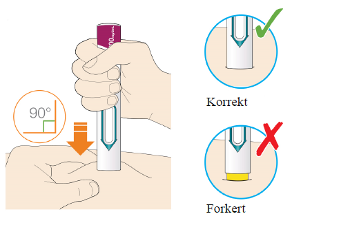 Praluent Sanofi-Aventis groupe injektionsvæske, opløsning i fyldt pen 300 mg