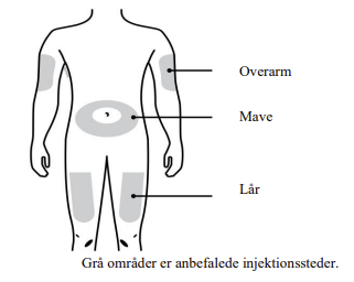 WEZENLA® injektionsvæske, opløsning, hætteglas 45 mg Amgen Technology (Ireland) Unlimited Company