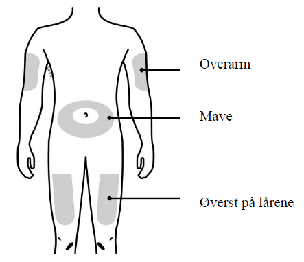Aranesp Amgen Europe BV injektionsvæske, opløsning i fyldt injektionssprøjte, injektionsvæske, opløsning, fyldt injektionssprøjte 20 mikrogram, 30 mikrogram, 40 mikrogram, 50 mikrogram, 60 mikrogram, 80 mikrogram, 100 mikrogram, 130 mikrogram, 150 mikrogram, 300 mikrogram og 500 mikrogram