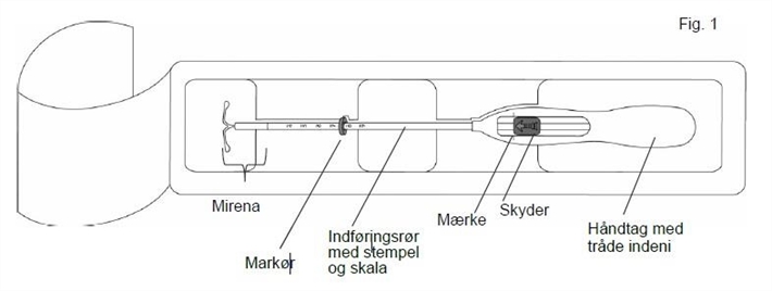 Mirena Orifarm A/S intrauterint indlæg 20 mikrog./24 timer